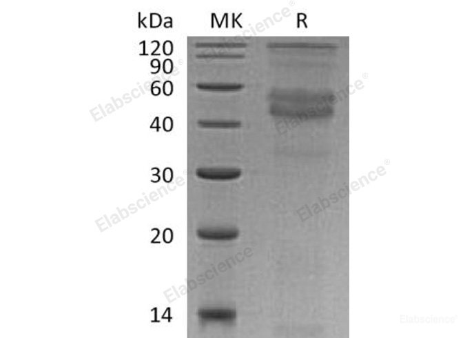 Recombinant Human Dentin Matrix Acidic Phosphoprotein 1/DMP-1 Protein(C-6His)-Elabscience