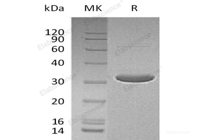 Recombinant Human Deoxycytidine Kinase/DCK Protein(N-6His, T7 tag)-Elabscience