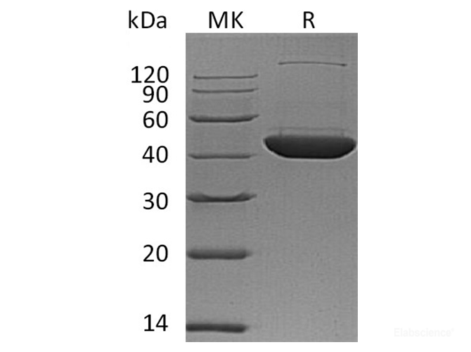 Recombinant Human Deoxyhypusine Synthase/DHS Protein(C-6His)-Elabscience