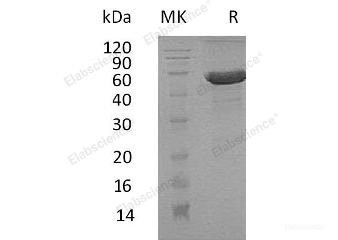 Recombinant Human Dermatopontin/DPT/TRAMP Protein(C-Fc-6His)-Elabscience