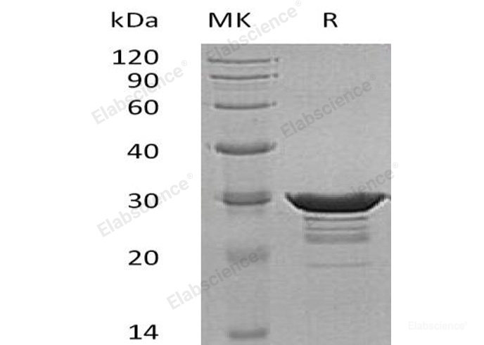 Recombinant Human Desmin Protein(N-6His)-Elabscience