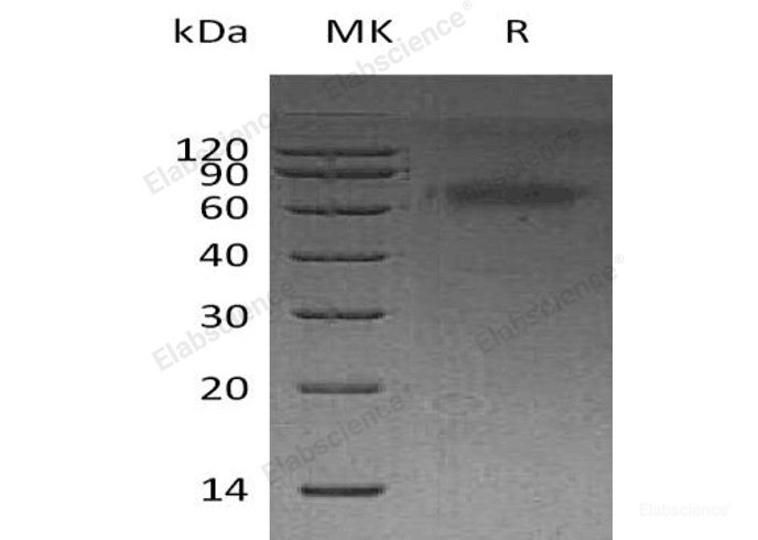 Recombinant Human Dickkopf-Related Protein 3/DKK3 Protein(C-6His)-Elabscience