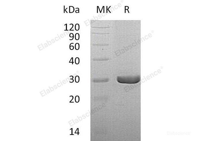 Recombinant Human Dihydropteridine Reductase/QDPR Protein(C-6His)-Elabscience