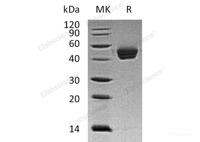 Recombinant Human Dipeptidyl-Peptidase 1/DPP1 Protein(C-6His)-Elabscience