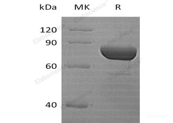 Recombinant Human Dipeptidyl-Peptidase 3/DPP3 Protein(N-6His)-Elabscience