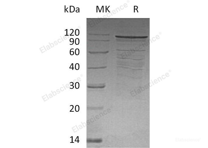 Recombinant Human Disks Large Homolog 4/DLG4/PSD95 Protein(N-6His)-Elabscience