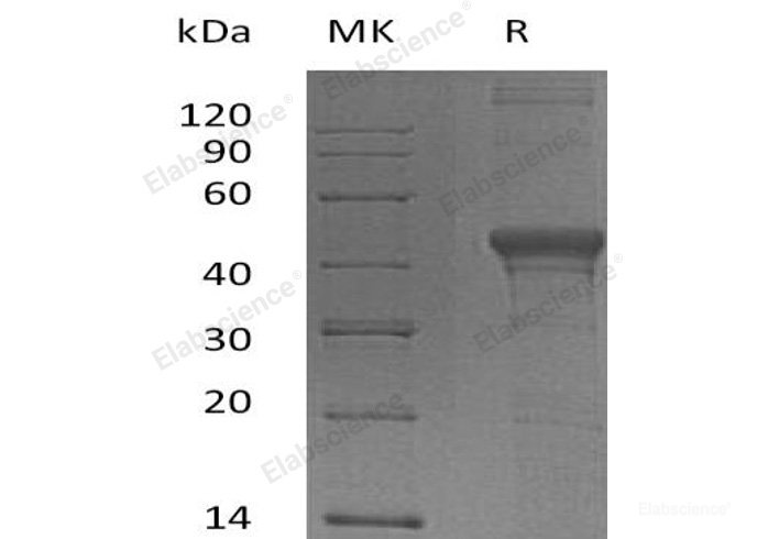 Recombinant Human DNA Fragmentation Factor Subunit α/DFFA/DFF45/ICAD Protein(N-6His)-Elabscience