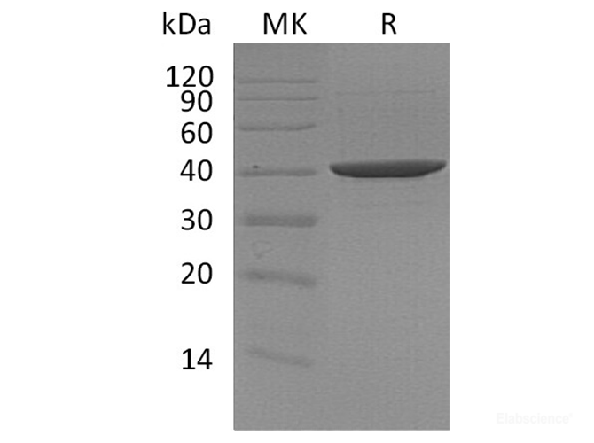 Recombinant Human DNA Polymerase β Protein(C-6His)-Elabscience