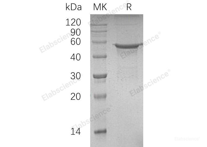 Recombinant Human DNA Polymerase δ Subunit 2/POLD2 Protein(C-6His)-Elabscience