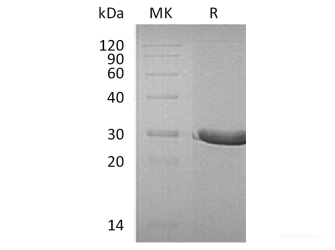 Recombinant Human D-Tyrosyl-tRNA Protein-Elabscience