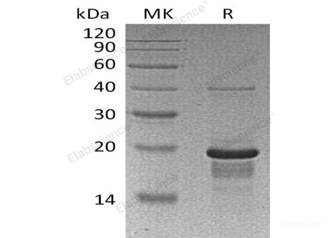 Recombinant Human Early Growth Response Protein 1/EGR1/ZNF225 Protein(N-6His) -Elabscience