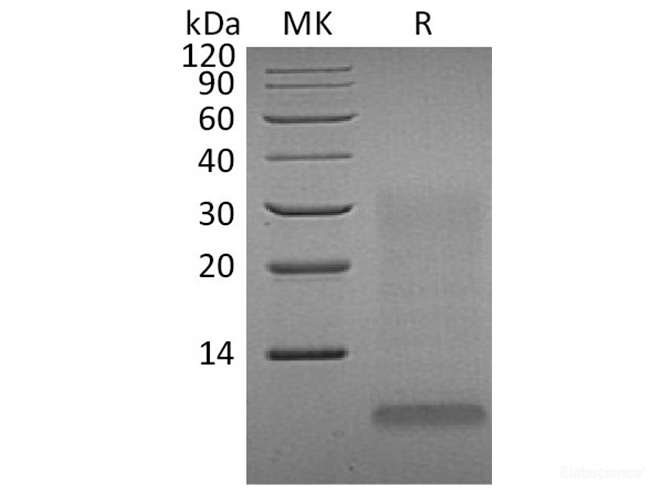 Recombinant Human Early Placenta Insulin-Like Peptide/INSL4/Placentin Protein(C-6His)-Elabscience