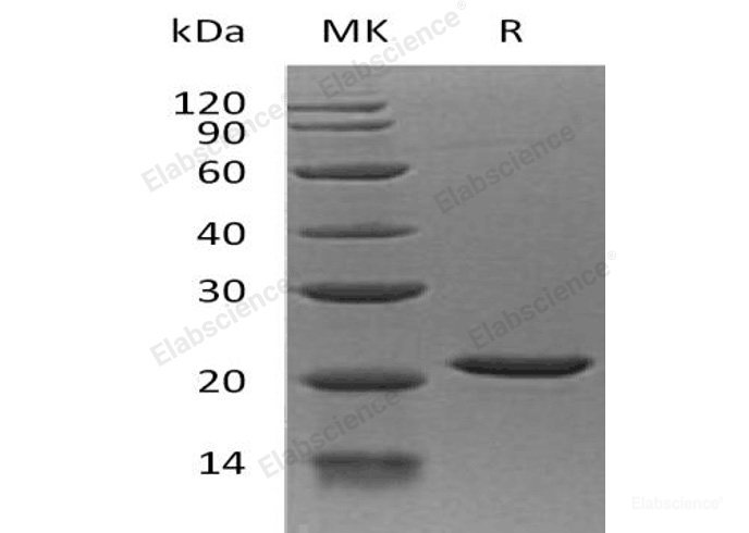 Recombinant Human EIF1A, X-Chromosomal/EIF1AX Protein(N-6His)  -Elabscience