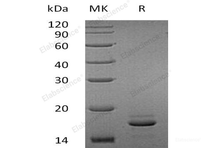 Recombinant Human EIF4E-Binding Protein 2/EIF4EBP2 Protein(N-6His)-Elabscience