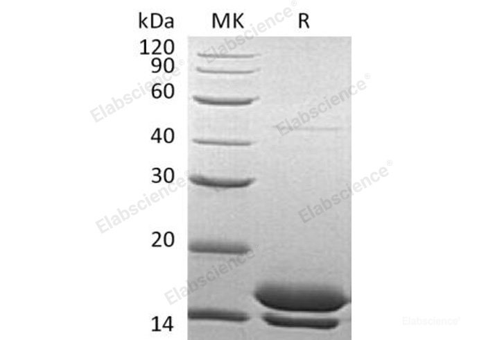 Recombinant Human Elafin/Trappin-2 Protein(C-6His)-Elabscience