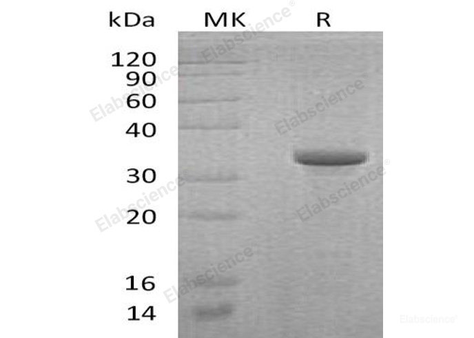 Recombinant Human Endoglin/CD105 Protein(N-Trx, 6His)-Elabscience
