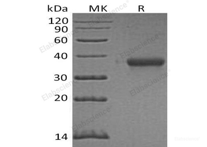 Recombinant Human Ephrin-A3/EFNA3 Protein(C-6His)-Elabscience