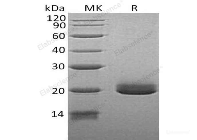 Recombinant Human Ephrin-A4/EFNA4 Protein(C-6His)-Elabscience