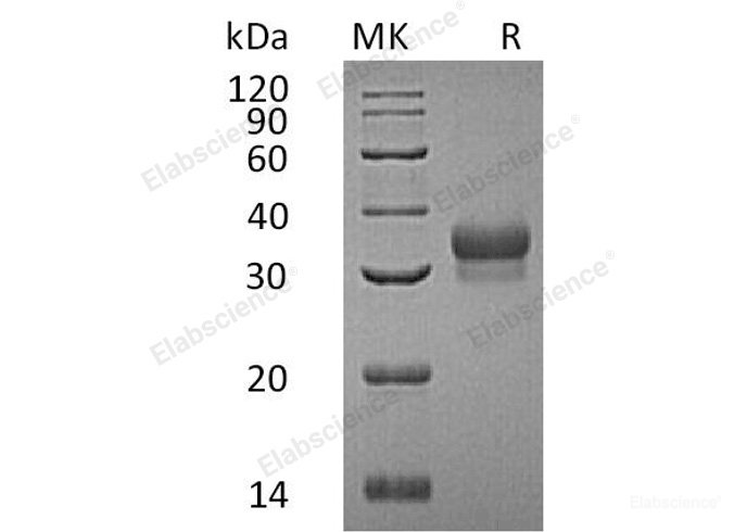 Recombinant Human Ephrin-B1/EFNB1 Protein(C-6His)-Elabscience