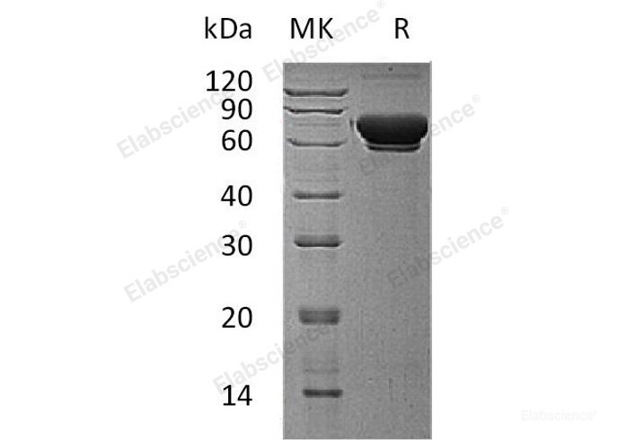 Recombinant Human ER α-1,2-Mannosidase/MAN1B1 Protein(C-6His)-Elabscience