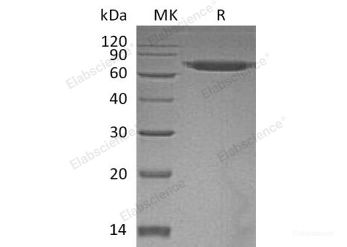 Recombinant Human ERO1-Like Protein α/ERO1L Protein(C-6His)-Elabscience