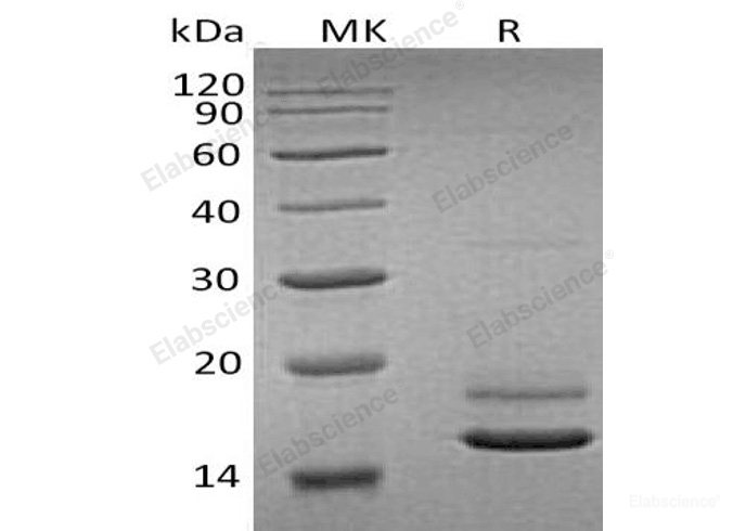 Recombinant Human Erythroid Membrane-Associated Protein/ERMAP Protein(C-6His)-Elabscience