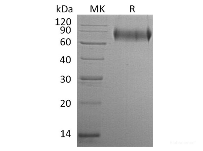 Recombinant Human E-Selectin//ELAM1/CD62E Protein(C-6His)-Elabscience