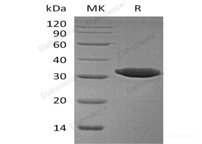 Recombinant Human Esterase D Protein(C-6His)-Elabscience