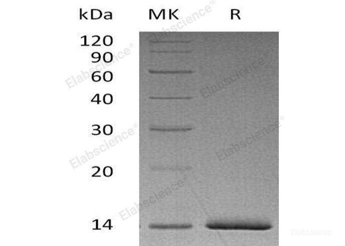 Recombinant Human Estrogen Receptor α/ERα/NR3A1 Protein(N-6His)-Elabscience