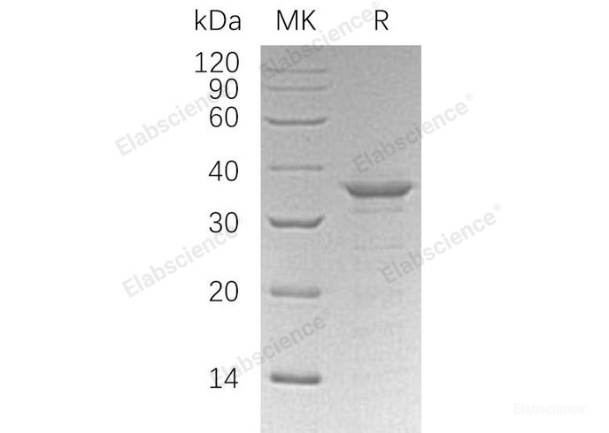 Recombinant Human ETS1/EWSR2/P54 Protein(N-6His)-Elabscience