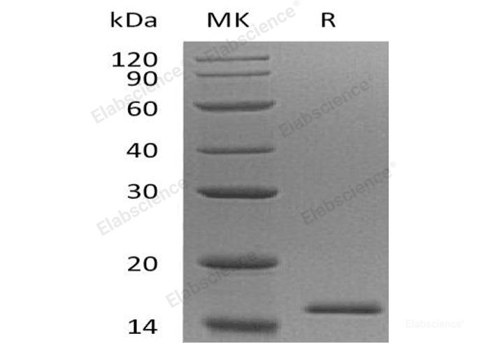 Recombinant Human Eukaryotic Translation Initiation Factor 1B/EIF1B Protein(N-6His)-Elabscience