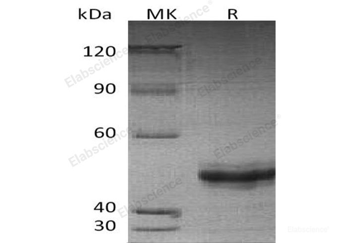 Recombinant Human Eukaryotic Translation Initiation Factor 5A-2/EIF5A2 Protein(N-6His)-Elabscience