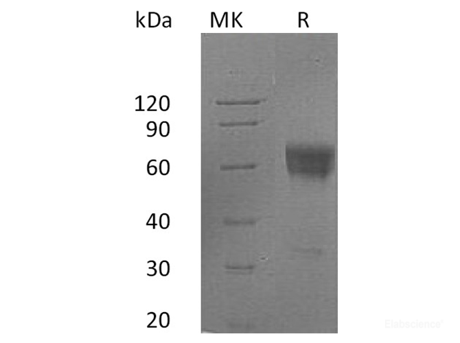 Recombinant Human Fas/TNFRSF6/CD95 Protein(C-Fc)-Elabscience