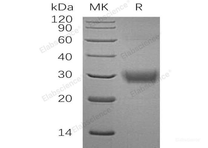 Recombinant Human Fc γ RIIa/FCGR2A/CD32a Protein(C-6His)-Elabscience