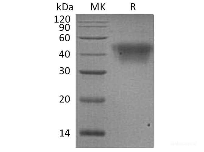 Recombinant Human Fc γ RIIIA/FCGR3A/CD16a Protein(C-6His)-Elabscience