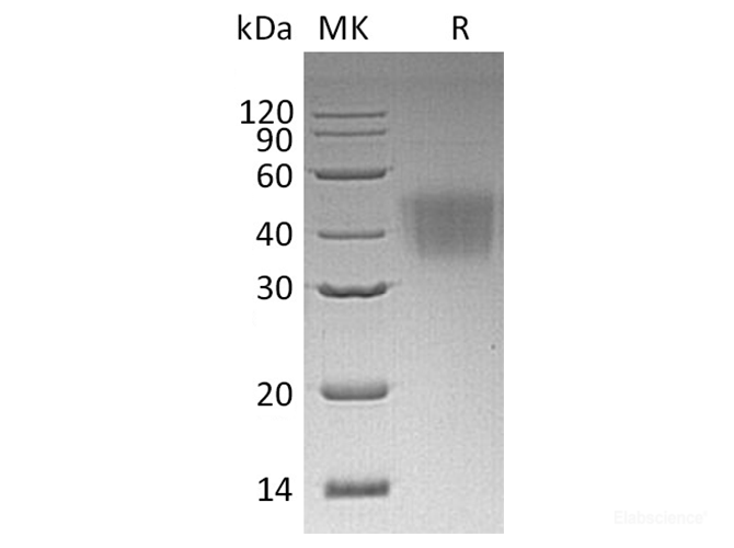 Recombinant Human Fc γ RIIIA/FCGR3A/CD16a Protein(C-6His,Val176Phe)-Elabscience