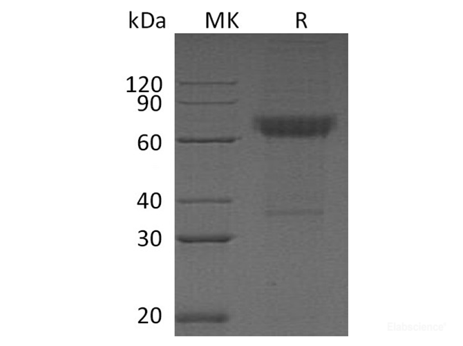 Recombinant Human Fc γ RIIIB/FCGR3B/CD16b Protein(C-Fc-6His)-Elabscience