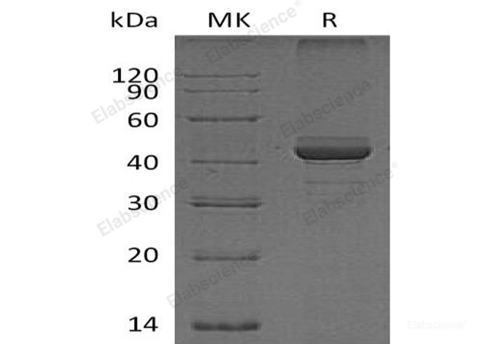 Recombinant Human FGF1 Intracellular-Binding Protein/FIBP Protein-Elabscience