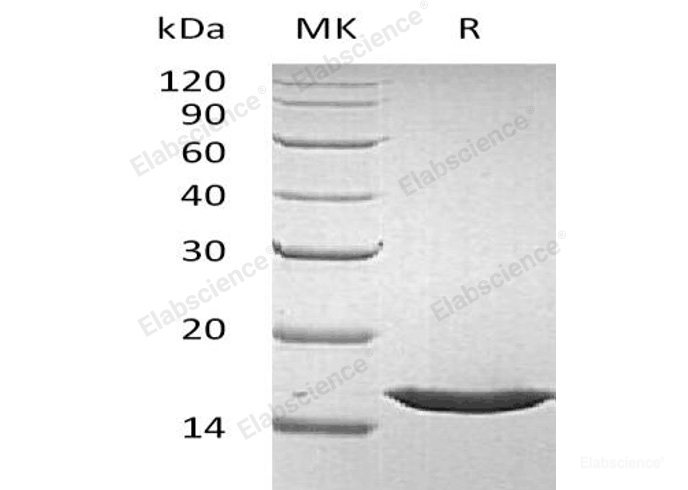 Recombinant Human Fibroblast Growth Factor 1/FGF-1/FGFa(Phe16-Asp155) Protein-Elabscience