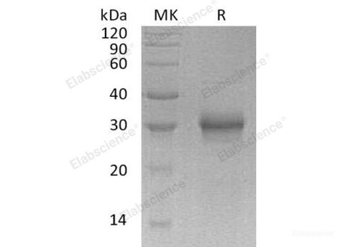 Recombinant Human Fibroblast Growth Factor 17/FGF-17 Protein(C-6His)-Elabscience