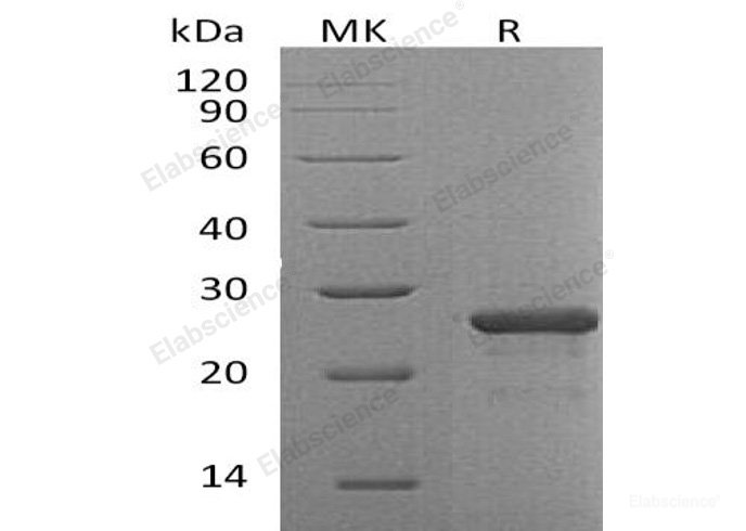Recombinant Human Fibroblast Growth Factor 19/FGF-19 Protein(N-6His)-Elabscience