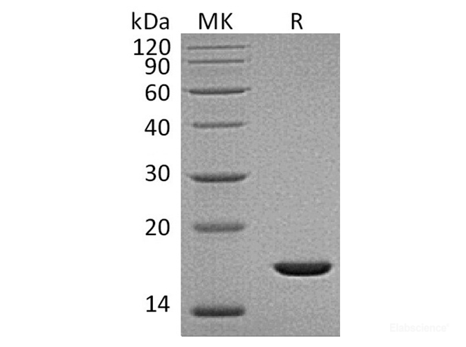 Recombinant Human Fibroblast Growth Factor 2/FGF-2/FGFb(Gly132-Ser288) Protein-Elabscience