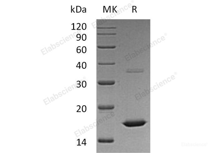 Recombinant Human Fibroblast Growth Factor 2/FGF-2/FGFb (Met134-Ser288) Protein-Elabscience