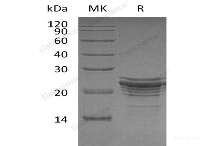 Recombinant Human Fibroblast Growth Factor 21/FGF-21 Protein(N-6His)-Elabscience