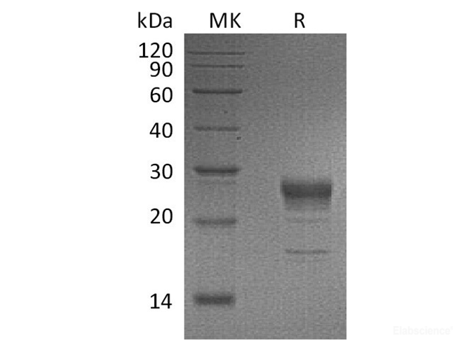 Recombinant Human Fibroblast Growth Factor 7/FGF-7/KGF Protein(C-6His)-Elabscience