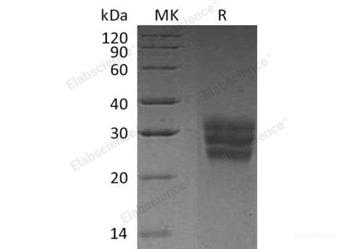 Recombinant Human Fms-Related Tyrosine Kinase 3 Ligand/FLT3LG Protein(C-6His)-Elabscience