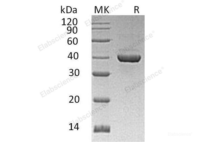 Recombinant Human Fructose-Bisphosphate Aldolase C/ALDOC Protein(C-6His)-Elabscience