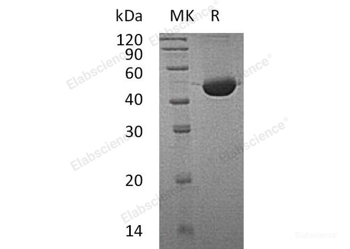 Recombinant Human Fumarylacetoacetase/FAH Protein(C-6His)-Elabscience