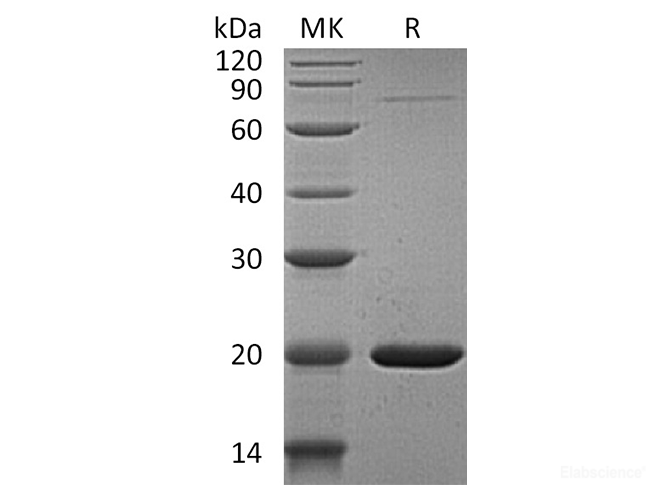 Recombinant Human GABA Receptor-Associated Protein-Like 1/GABARAPL1 Protein(N-6His)-Elabscience