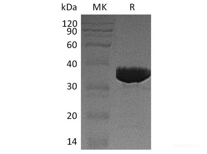 Recombinant Human Galactose Mutarotase/GALM Protein(C-6His)-Elabscience